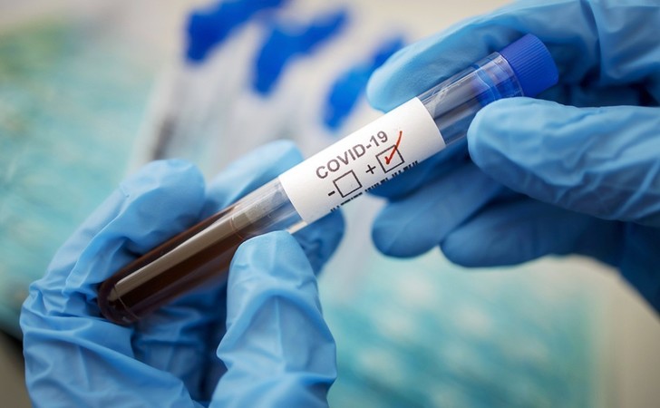 Всесвітня організація охорони здоров'я (ВООЗ) створила новий експрес-тест на коронавірус, який дає результат за кілька хвилин і коштує близько $5 (140 гривень).