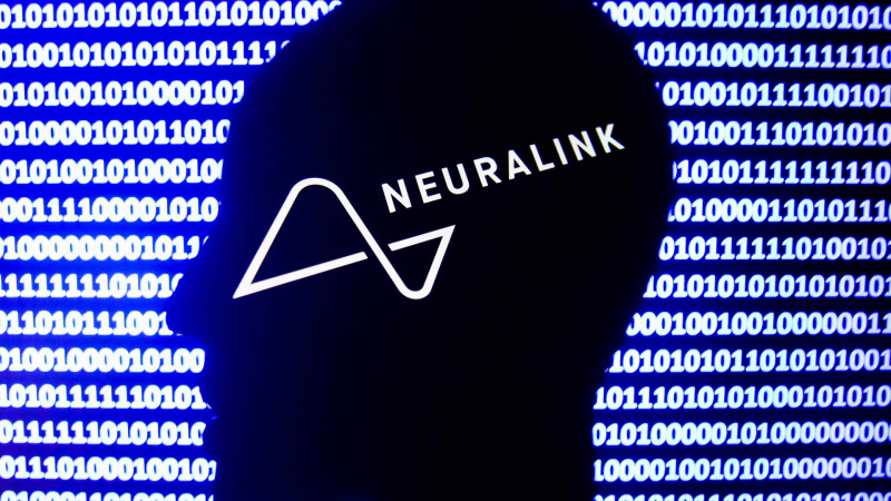 Neuralink провела первую в истории операцию по вживлению в мозг человека импланта.